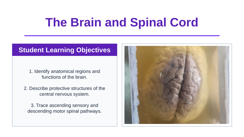 The Brain & Spinal Cord Slide Show Presentation sample page