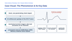 The Cardiovascular System Phenomena-Based Lesson: The 10–30 ms Window: Why a Baseball Impact Can Instantly Stop a Healthy Heart Presentation sample page