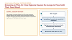 The Respiratory System Scaffolded Phenomena-Based Lesson: Drowning in Thin Air: How Hypoxia Causes the Lungs to Flood with Their Own Blood Presentation sample page