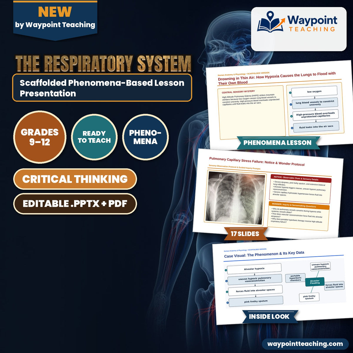 The Respiratory System Scaffolded Phenomena-Based Lesson: Drowning in Thin Air: How Hypoxia Causes the Lungs to Flood with Their Own Blood Presentation cover