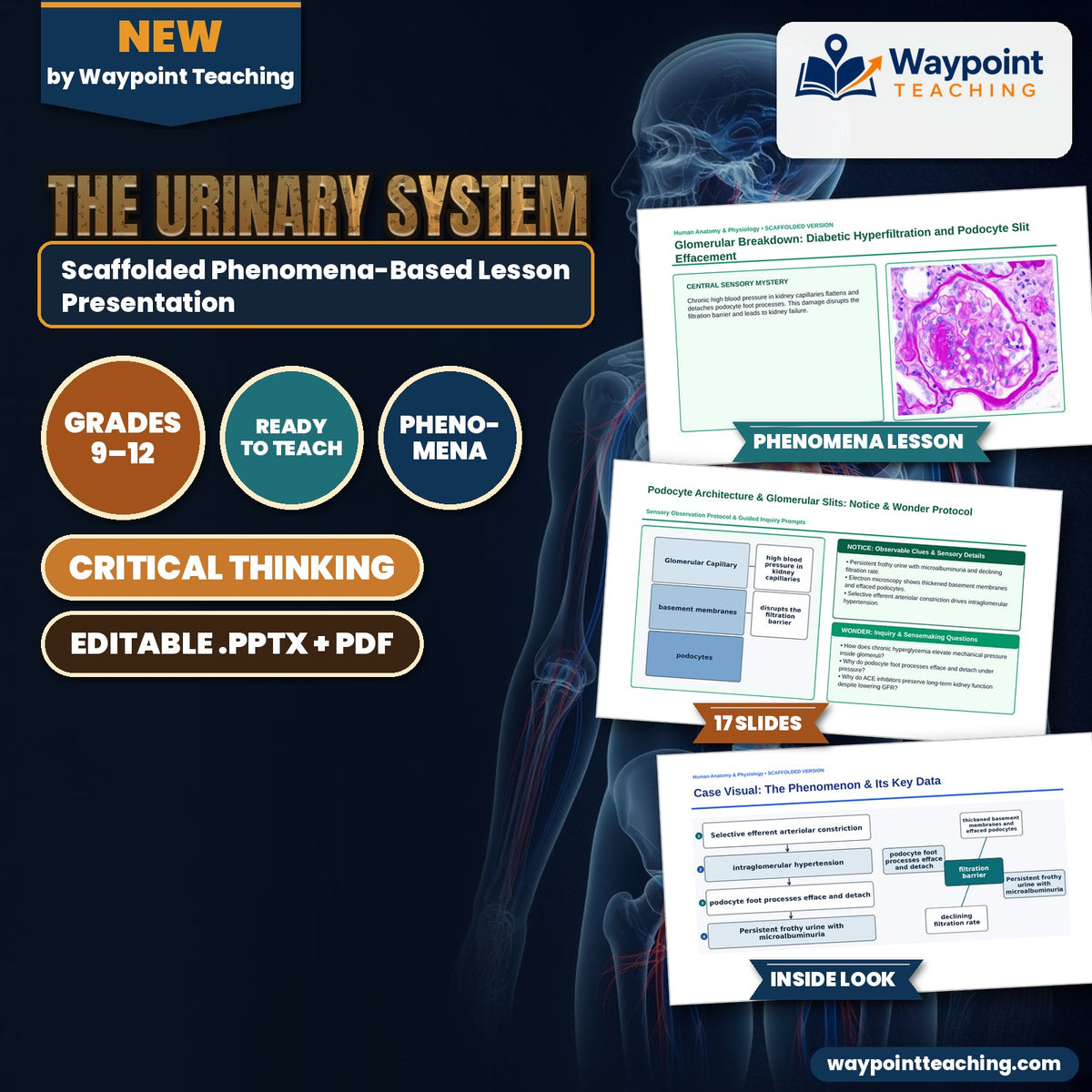 The Urinary System Scaffolded Phenomena-Based Lesson: Glomerular Breakdown: Diabetic Hyperfiltration and Podocyte Slit Effacement Presentation cover